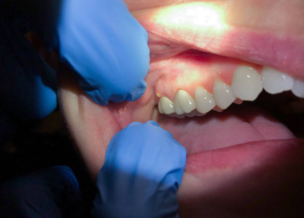 Best Broken Tooth Emergency  in East Lake, FL